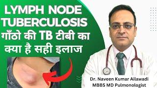 Lymph  Node Tuberculosis गाँठो की TB टीबी का  क्या है सही इलाज #drnaveenailawadi #lungdoctor