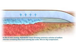 Aquacel Foam