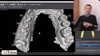 Blueskyplan 4 13: Importazione e Marcatura Denti   Modulo Ortodonzia