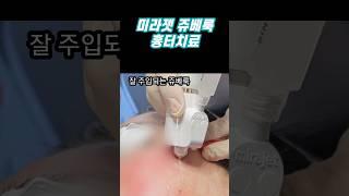 미라젯 흉터치료 #미라젯 #쥬베룩