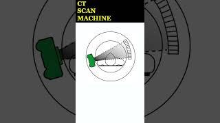 25 seconds explainer: How CT Scan Works #explained #science