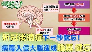 下一秒就忘！ 新冠後遺症25%出現腦霧會健忘 健康2.0