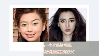 8位女星换脸式整容，你最受不了哪一位