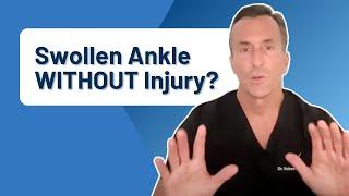 What Causes Ankle Pain and Swelling WITHOUT Injury?