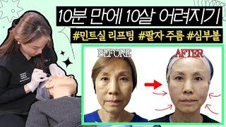 [ENG/JPN] 60대 실리프팅 직후 대공개10분만에 10살어려지는 #민트실리프팅#팔자주름#입가주름#주름필러