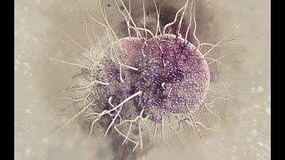 Drug-Resistant Gonorrhea: An Urgent Public Health Issue