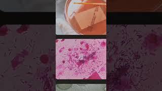 #Microbiology Lab practice - Diagnosis, isolation of bacteria and Identification