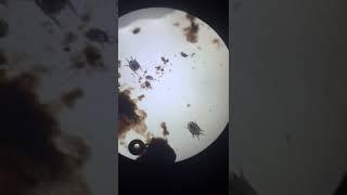 Ear Mites