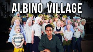 Visiting the Secret Albino Village in Tanzania (Too White to Live)