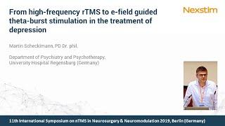 From high-frequency rTMS to e-field guided iTBS stimulation in treatment of depression