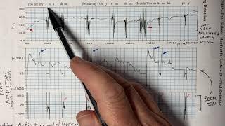 ECE402 Lecture 20 (Pitch Detection)