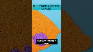 Explore the scientific link between nulliparity and breast cancer risk. #BreastCancer