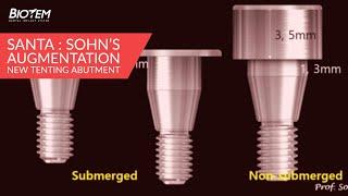 [바이오템 | BIOTEM] SANTA : Sohn’s Augmentation New Tenting Abutment