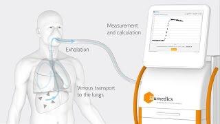 LiMAx - Real-time analysis of liver function capacity