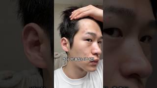 피부과 원장님이 알려주신 효과 좋은 여드름 시술 3가지