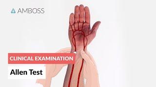 Modified Allen Test - Clinical Examination