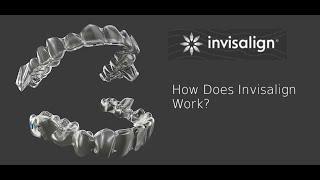 Invisalign clear aligners - how it works? | www.bangkokbraces.com