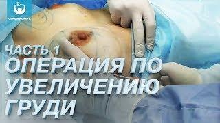 Операция по увеличению груди у Сергей Хаустов. Пластическая хирургия в Клинике GENESIS DNEPR Часть 1