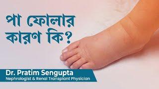 পা ফোলার কারণ কি | Causes for  swollen legs and feet  or Edema in Bengali