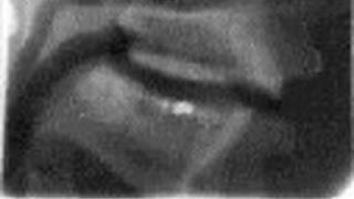 Kevin Munhall Cineradiography Example: Le boulanger but onze bières