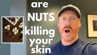 Why 99 % of NUTS are an unhealthy food your skin health / What nuts are SAFE to eat for healthy skin