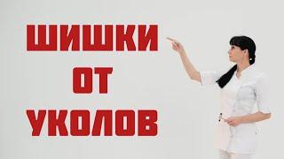 "Шишки" от уколов. Как лечить. Доктор Лисенкова