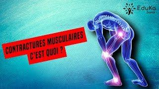 Contractures musculaires : C'est quoi ?