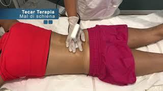 A cosa serve la Tecar Terapia?