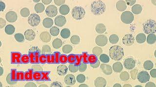 RETICULOCYTE INDICES