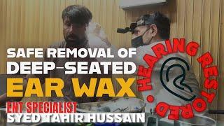 Safe Removal of Deep-Seated Ear Wax Restores Hearing
