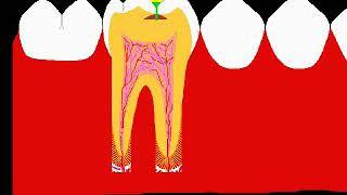 Save the Teeth...timely visit to your dental surgeon may save your teeth