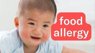 BABY FOOD | What are babies allergic to?