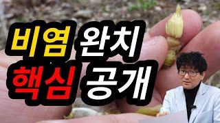 #비염#축농증 완전히 치료하는 방법을 소개합니다. 함께 활용하면 좋은 약초도 소개해요[약초방송]