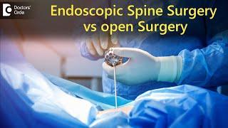 What is Endoscopic Spine Surgery?Endoscopic Spine Surgery vs Open Surgery-Dr.Kodlady Surendra Shetty