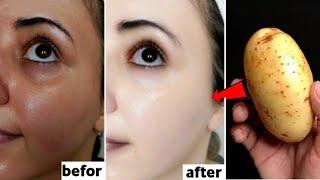 Japanese secret to whitening 10 degrées that eliminates pigmentation and dark spots