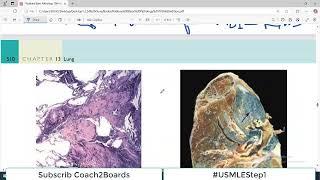 Chp#13 Robbins Patho | Lung Pathology | Coal Worker Pneumoconiosis | Restrictive Lung Disorders