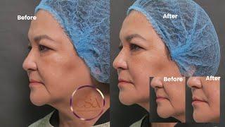 “Maintaining a natural, youthful look for those ages 60 and above “ | Dr. Contessa Salvador - Alapag