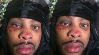 RAPPER WACKA FLACKA LIES ABOUT BEING JUMPED BY 10 MEN | 13 PPL HIT IN NYC MASS TRAGEDY!