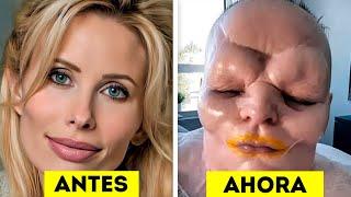 15 TERRIBLES Cirugías Plásticas de Famosos Que Fracasaron