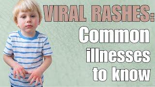 Pediatrician Explains Viral Rashes and Fifth Disease and Sixth Disease (Roseola)