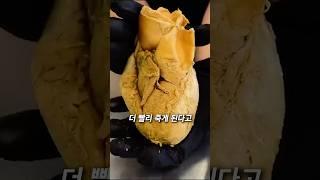 운동하면 심장이 이렇게 됩니다 ㅠ