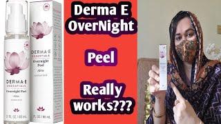 Derma E Overnight Peel REVIEW|Best for Glowing skin and pigmentation |Glowingwithsaima