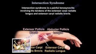 Intersection Syndrome - Everything You Need To Know - Dr. Nabil Ebraheim