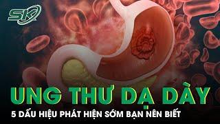 5 Biểu Hiện Của Bệnh Ung Thư Dạ Dày Ai Cũng Cần Biết I SKĐS