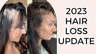 2023 Hair Loss Update | Deepa Berar