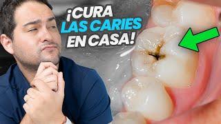 LA VERDAD SOBRE LA CARIES DENTAL ¿Como curarla en casa?