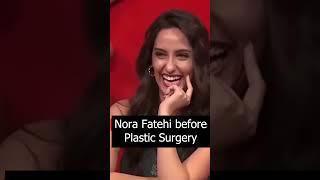 Let's Decode what Plastic Surgeries Nora fatehi has undergone.