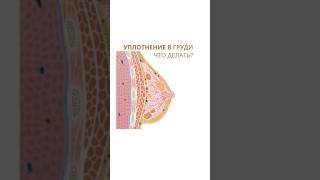 Уплотнение в груди. Что делать? #маммолог #маммологонколог #маммологмосква #женскоездоровье