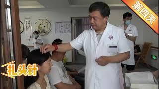 于卫东专家病例分享：视物模糊20年患者 #中醫 #retinitispigmentosa #traditionalchinesemedicine