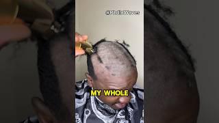 I scalped my 360 waves - bald head routine